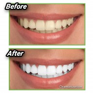 Miracle Teeth - uhlie pre bielenie zubov